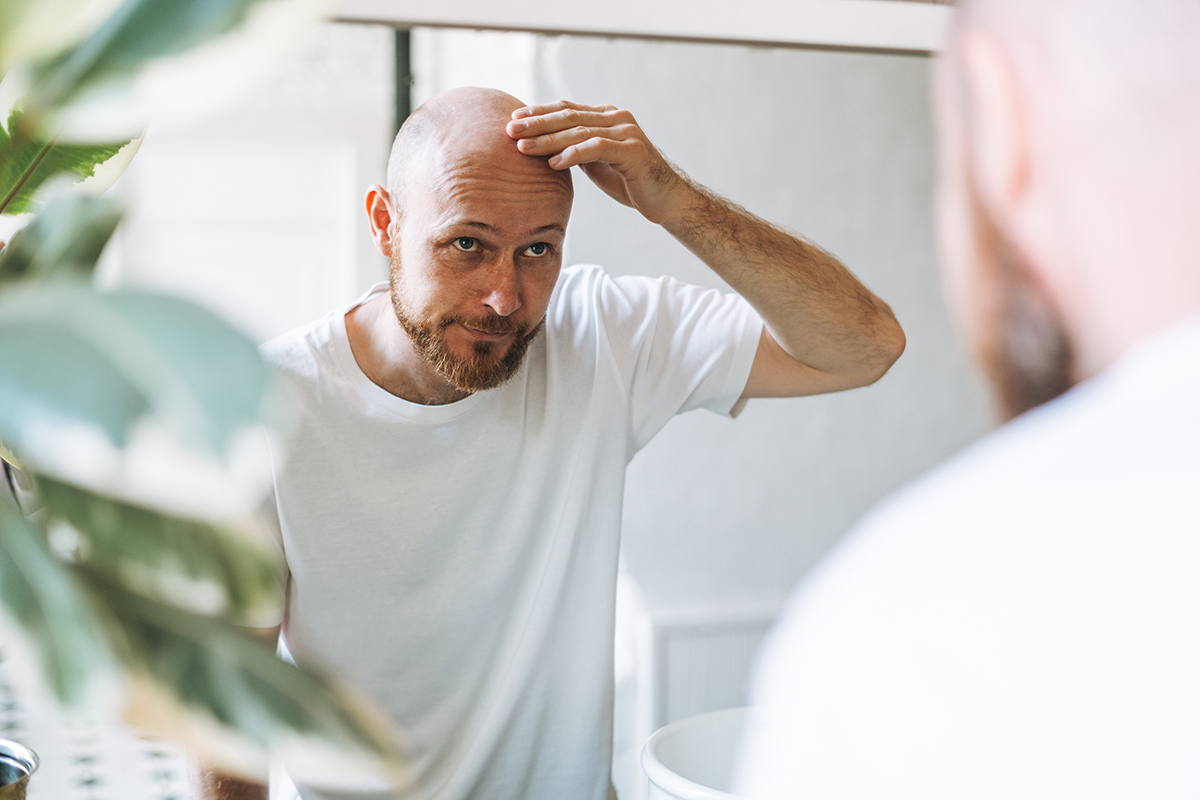 doctor, alopecia, injerto, cabello, calvicie, salud, cirugía